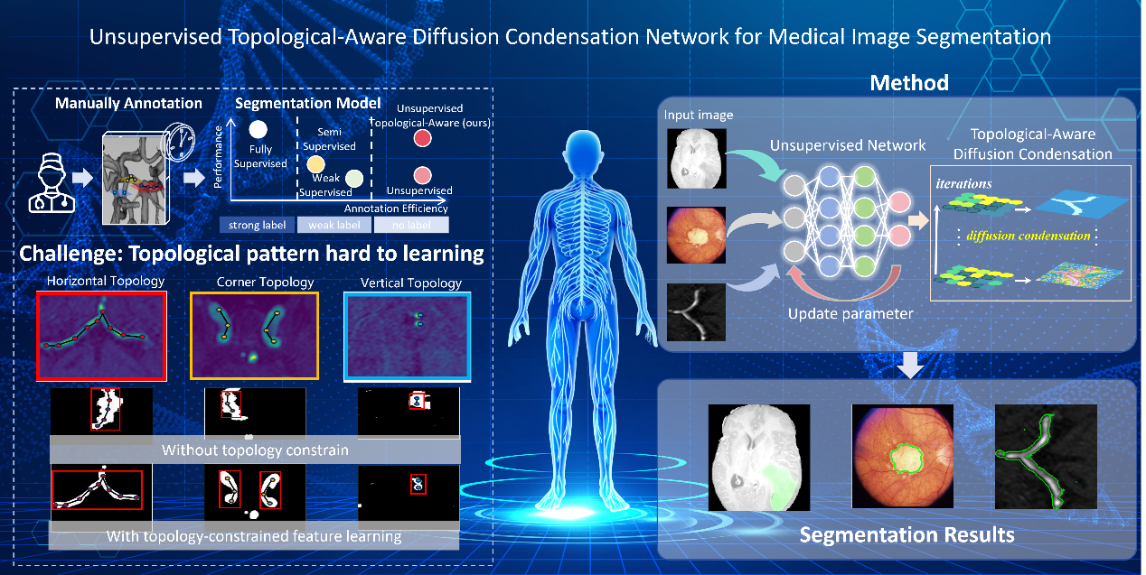 IEEE JBHI | 秦文健研究员团队提出无监督扩散分割模型，突破多模态医学图像无监督分割中解剖结构拓扑学习的难题