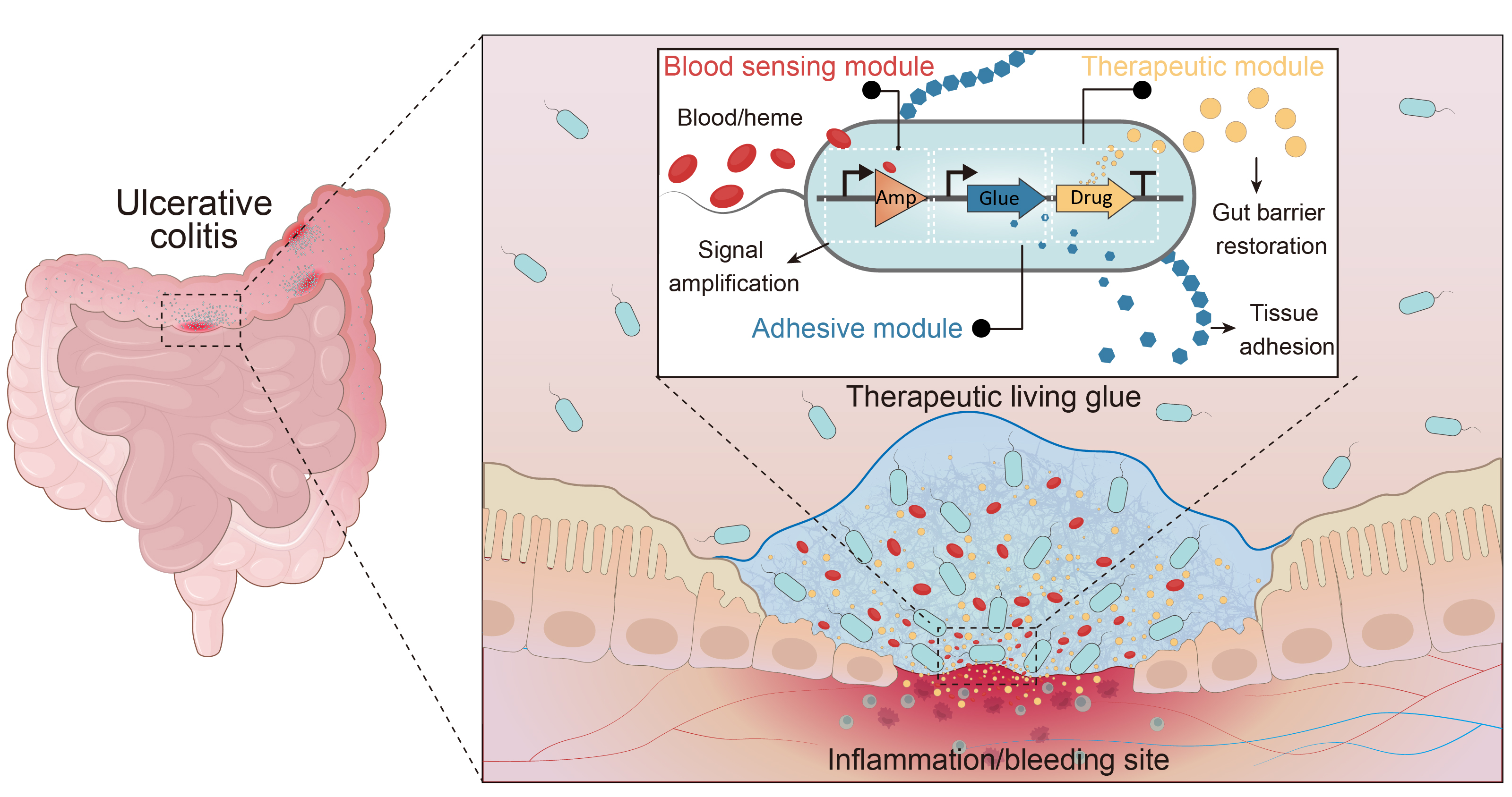 Nature Biotechnology | 靶向病灶的“智能活胶水”：针对炎症性肠病的活体治疗新策略
