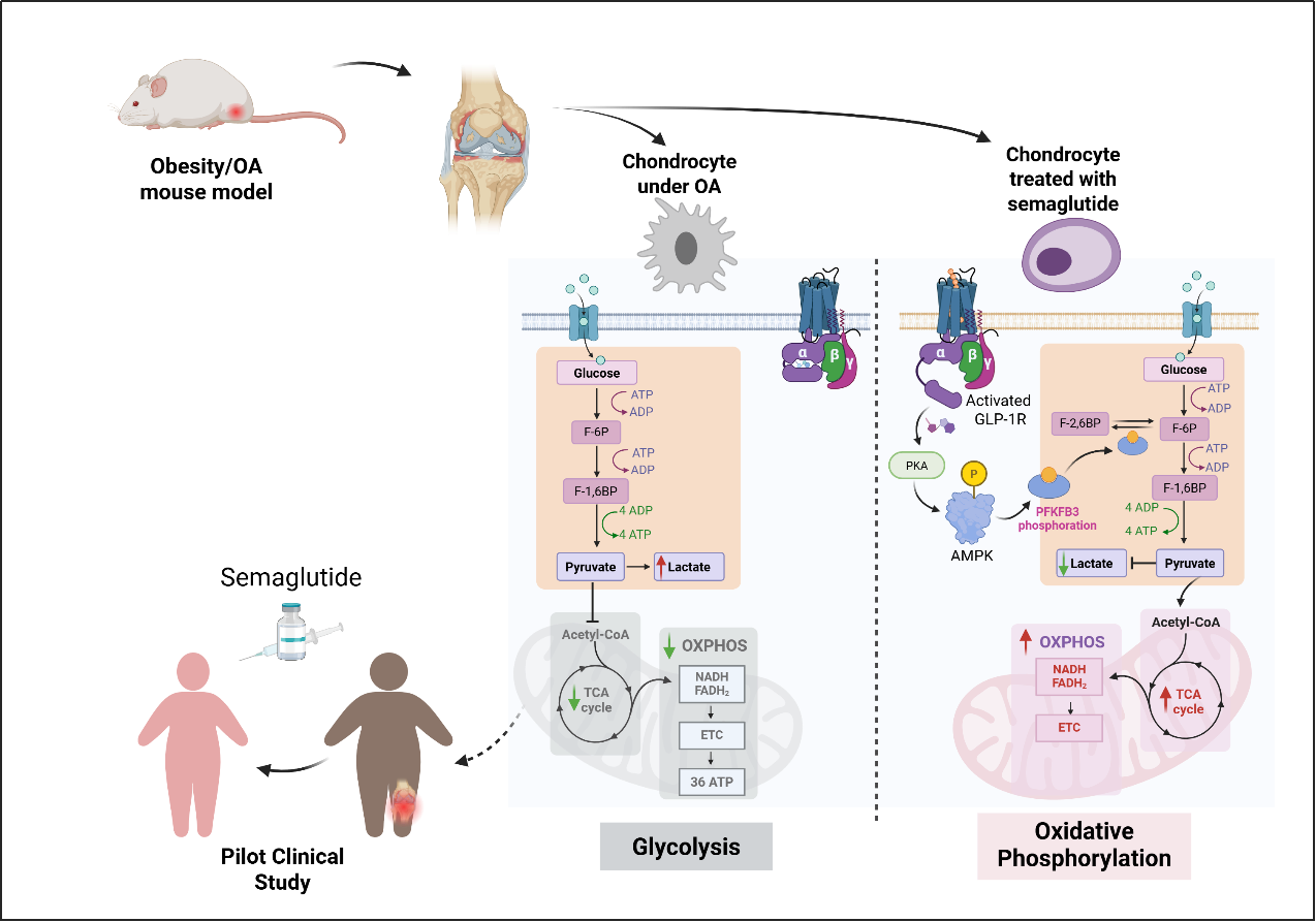 Cell Metabolism | “减肥神药”也能治疗骨关节炎？科学家揭示其关键机制