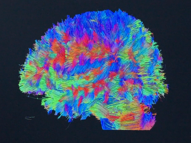 Centre for Brain Connectome and Behavior